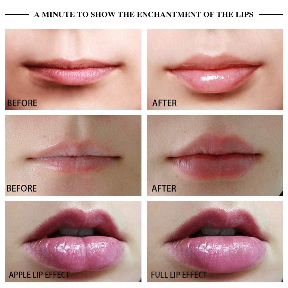 Miracle Lip Plumper